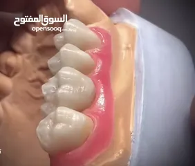  19 مختبرات لين للاسنان لصناعة كافة أنواع التركيبات الثابتة والمتحركة والتركيبات التقويمية وزراعة لاسنان
