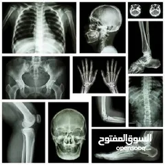  3 مركز اشعه ذات سمعه مرموقه وحركة ممتازه للبيع