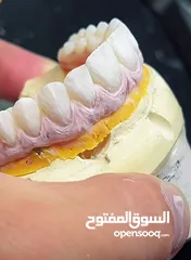  12 مختبرات لين للاسنان لصناعة كافة أنواع التركيبات الثابتة والمتحركة والتركيبات التقويمية وزراعة لاسنان