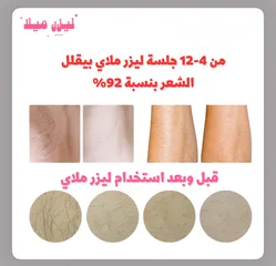  6 ليزر منزلي لازالة الشعر  ليزر ملاي T3