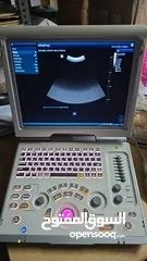  9 Ultrasound