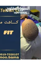  6 زراعة الشعر الطبيعي في ايران طهران