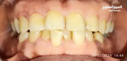 8 علاج اسنان مدينة الرياض