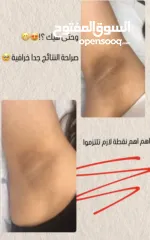  2 مُزيل عرق Shima Line