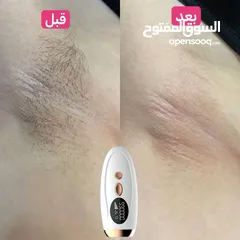  2 IPL HAIR REMOVAL DEVICE  الليزر الرهيب