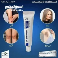  1 كريم #تريتوسبوت الأصلي آمن على البشرة  نكفل لكم النتائج  يستخدم مرهم تريتوسبوت لعلاج الحالات
