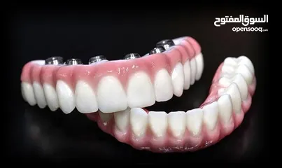  5 زراعة الاسنان الرقمية ( بدون جراحة بدون الم )