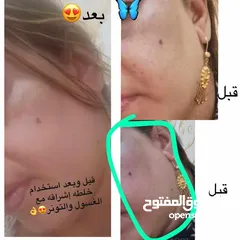  18 منتجات اشراقه الرهيبه والمشهوره خبره 14 سنه منتجات علاجيه تجميليه للعنايه بالبشره والجسم والشعر