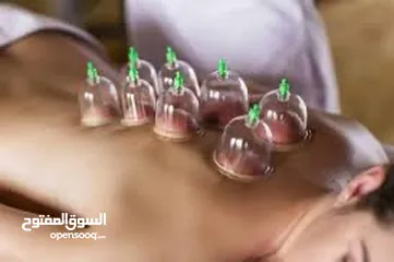  1 جلسات حجامة