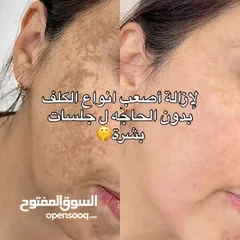  6 كريم هاي كوين