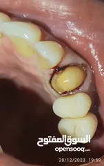  5 علاج اسنان مدينة الرياض