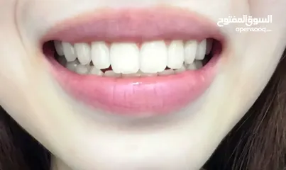  9 بودة تبييض الأسنان