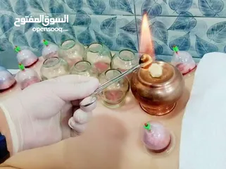  9 الحجامة للنساء..شفاء الحجامة ليس بكثرة الدم و إنما بالتشريط السليم والطريقة المثلى.. الحجامة وصية ..