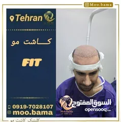  9 زراعة الشعر الطبيعي في ايران طهران