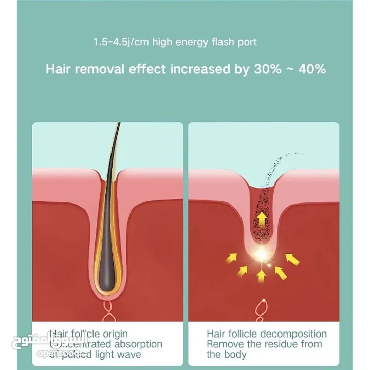 تخفيضات جهاز ليزر لإزالة الشعر نهائيا احدث جهاز 2024 مع 4 أوضاع لتحديد الجسم بخاصية IPLحماية للبشره