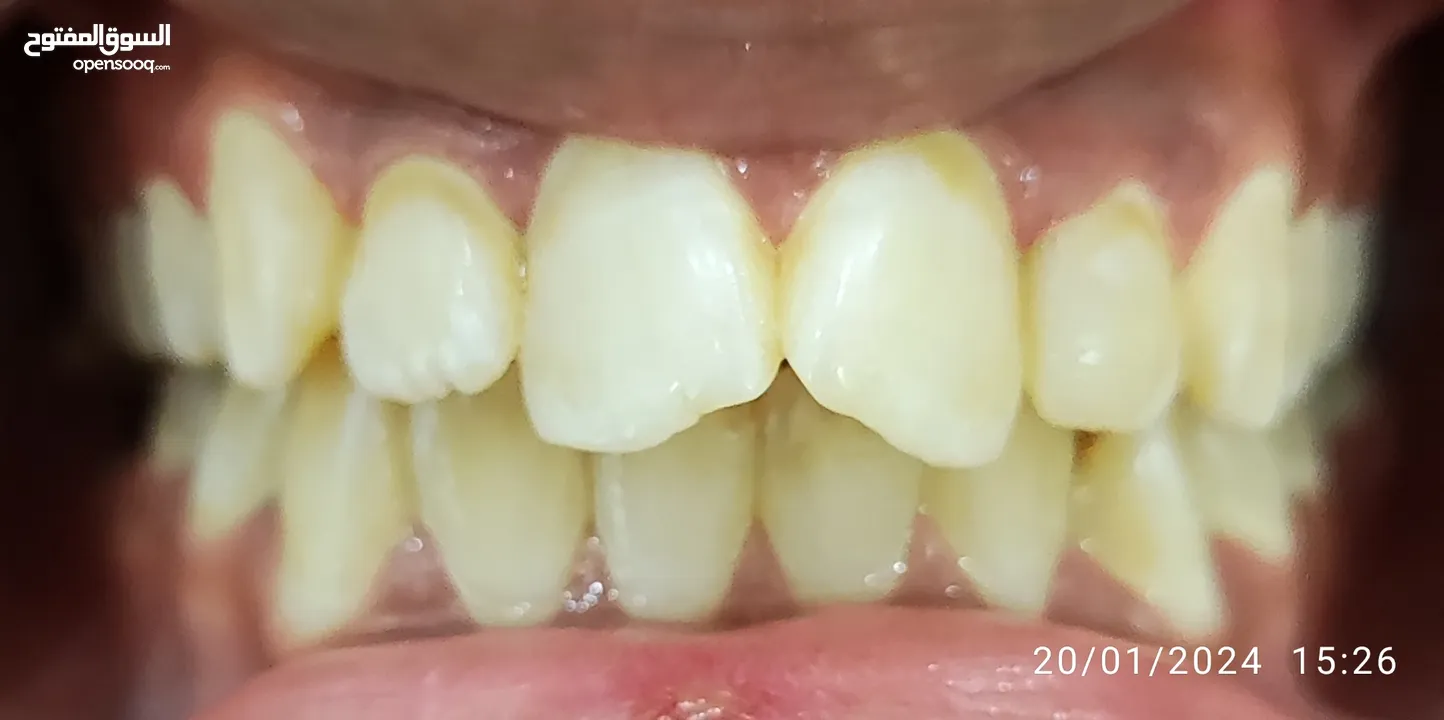 علاج اسنان مدينة الرياض