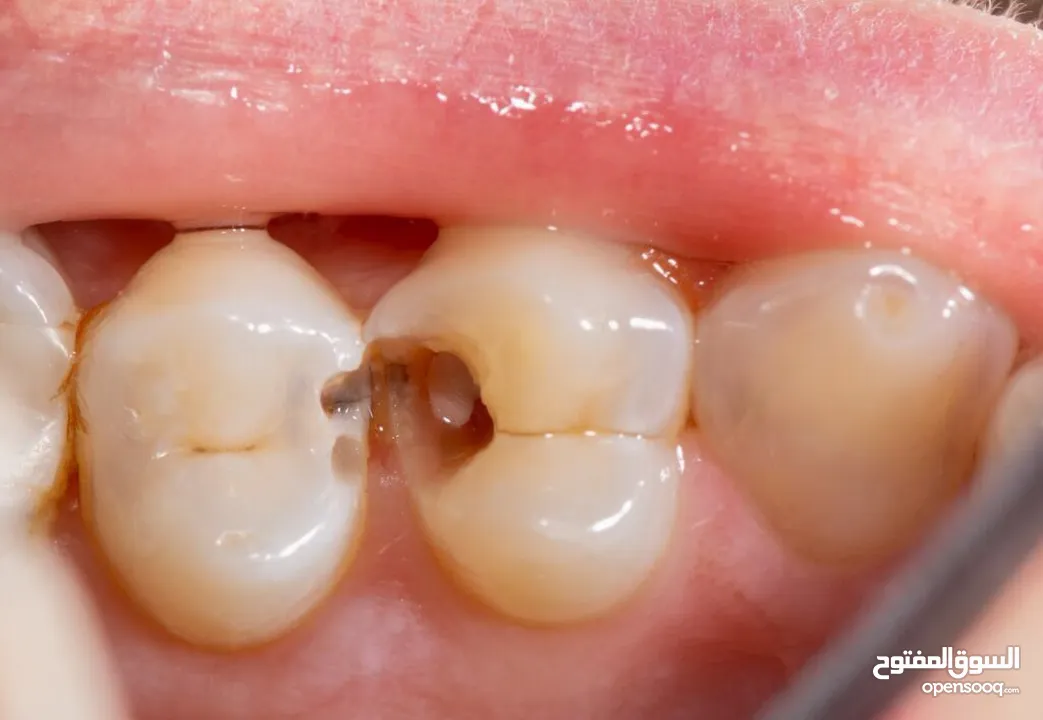 خدمات  طب اسنان مجانية وممتازة