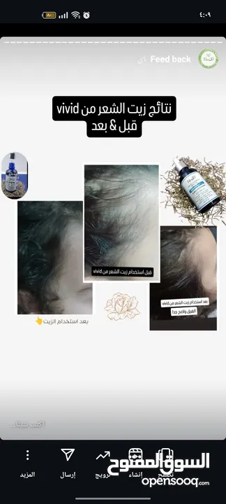 كريم ازالة التصبغات والكلف نتائج مضمونه 100%