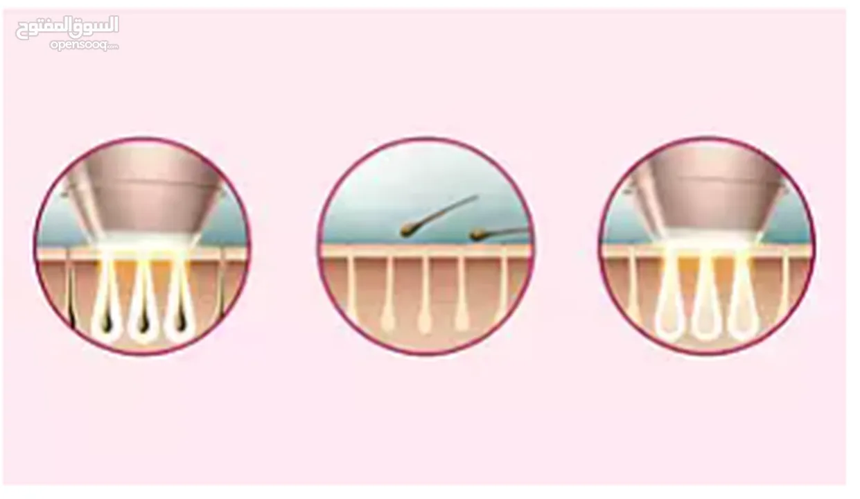 جهاز فيلبس ازالة الشعر