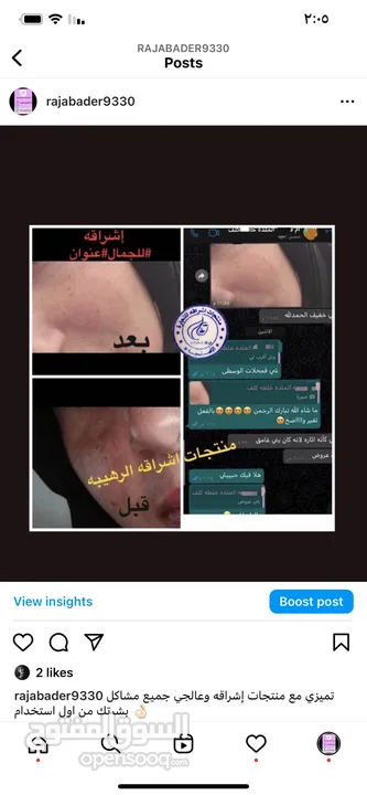 منتجات اشراقه الرهيبه والمشهوره خبره 14 سنه منتجات علاجيه تجميليه للعنايه بالبشره والجسم والشعر