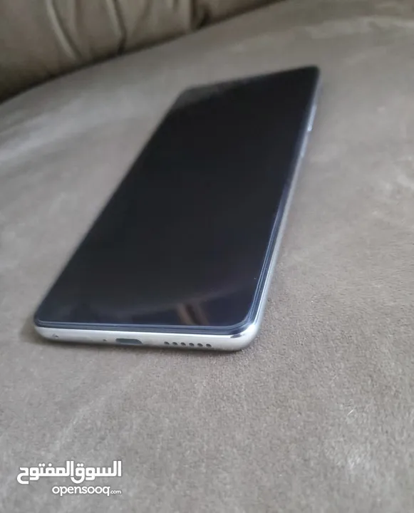 شاومي 11t pro وكاله