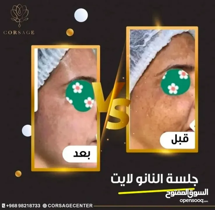 خدمات مركز تجميل