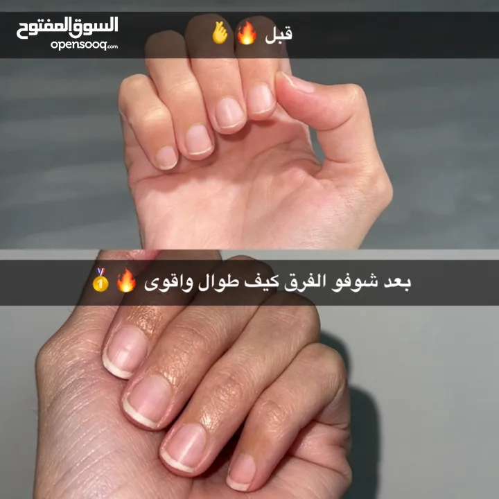 مقوي اظافر ShimaLine