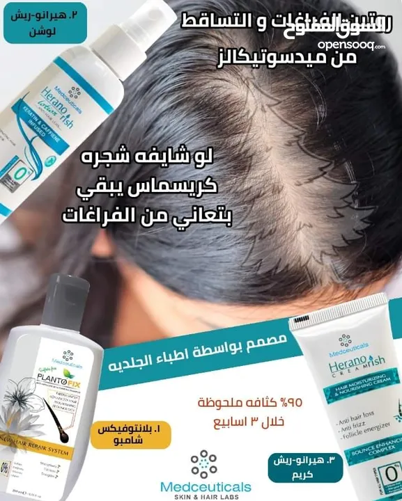 معالجة مشاكل الشعر
