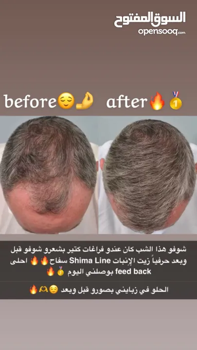 زيت الإِنبات ShimaLine