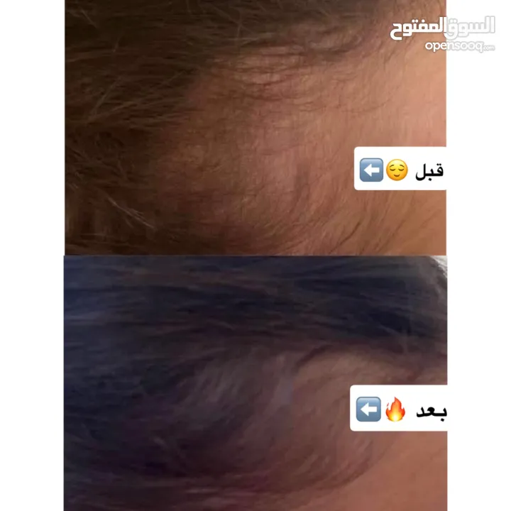 زيت الإِنبات ShimaLine