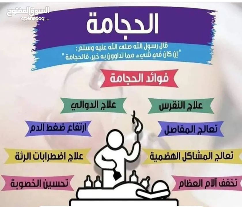 حجامة نبوية على يد طبيب