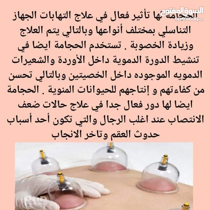 مركز طيبة العرب للحجامة    الحجامة فى مسقط