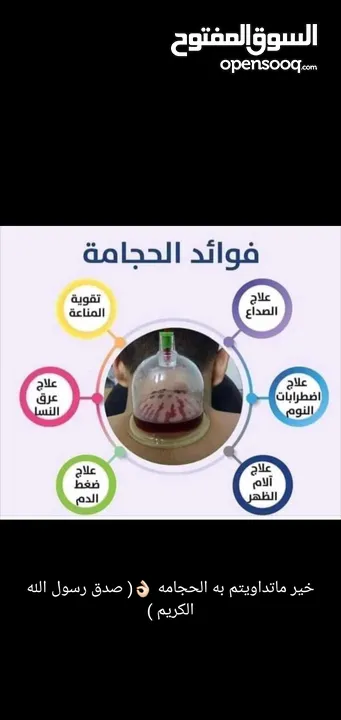 الحجامة للنساء..شفاء الحجامة ليس بكثرة الدم و إنما بالتشريط السليم والطريقة المثلى.. الحجامة وصية ..