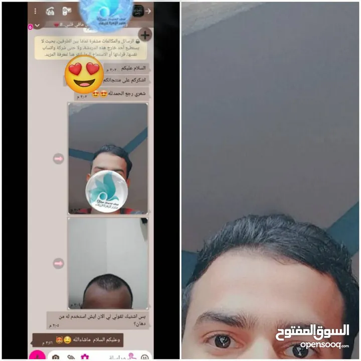 اقوى زيت عالمياً لتطويل وتكثيف الشعر