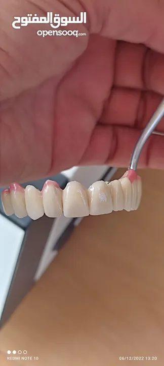 مختبرات لين لصناعة الاسنان