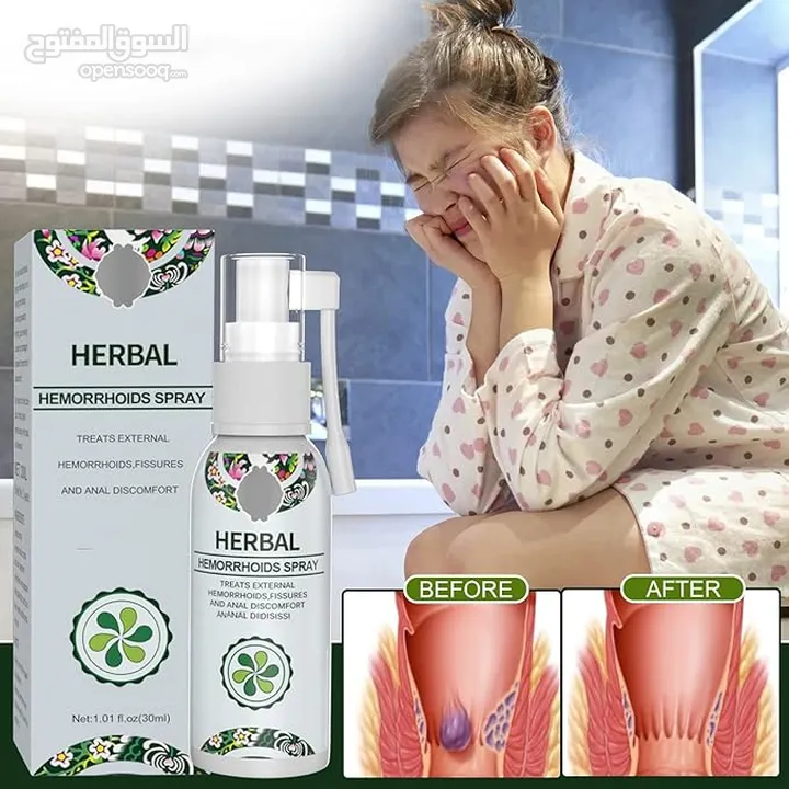 Herbal Spray for Hemorrhoids/Piles Treatment