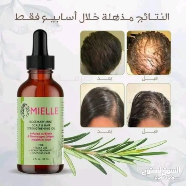 بكج ميلي بإكليل الجبل لإنبات الشعر وسد الفراغات وتقوية البيبي هير وزيادة الطول أصلي 100%