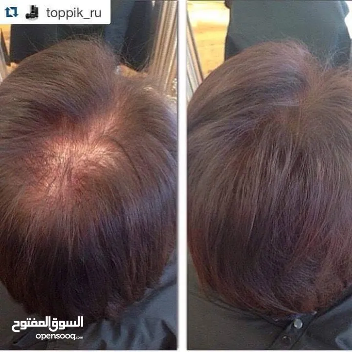 توبيك Toppik ، الحل الفوري للشعر الخفيف والصلع يقوم توبيك بملئ المناطق الفارغة بشكل فوري و يعوض