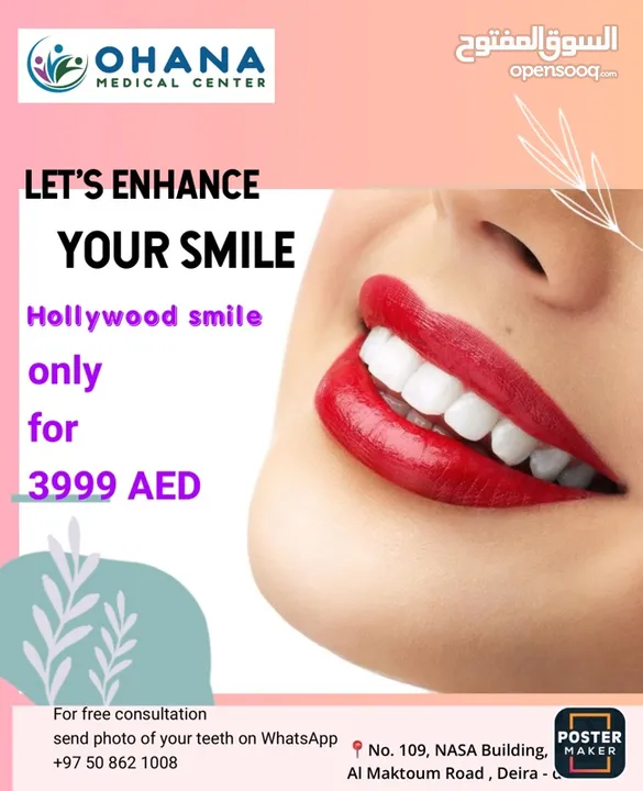 Hollywoodsmile , laminate veneer , smile design