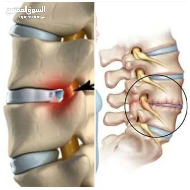 دورات سباحه وجلسات علاجيه