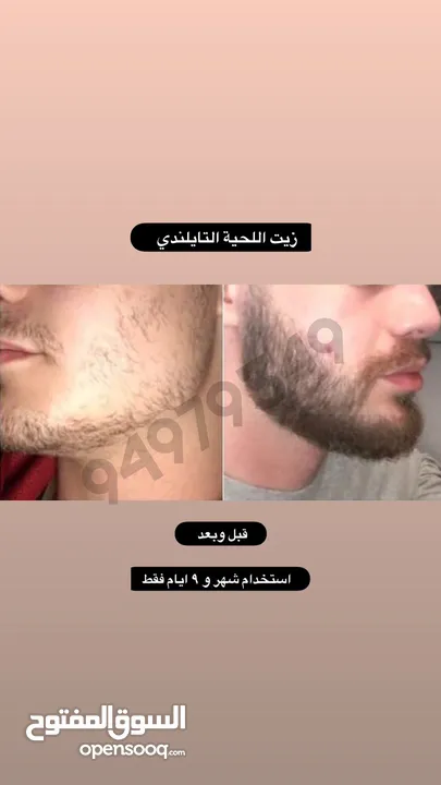 ينبت ويكثف اللحية والشنب/ مجرب ومضمون