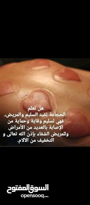 الحجامة للنساء..شفاء الحجامة ليس بكثرة الدم و إنما بالتشريط السليم والطريقة المثلى.. الحجامة وصية ..
