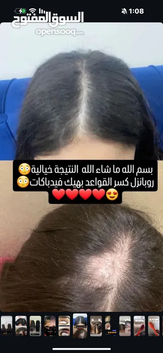 زيت رابونزل لتكثيف الشعر وإطالته