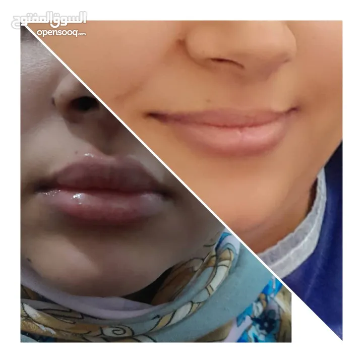 تجمیل زراعه الشعر