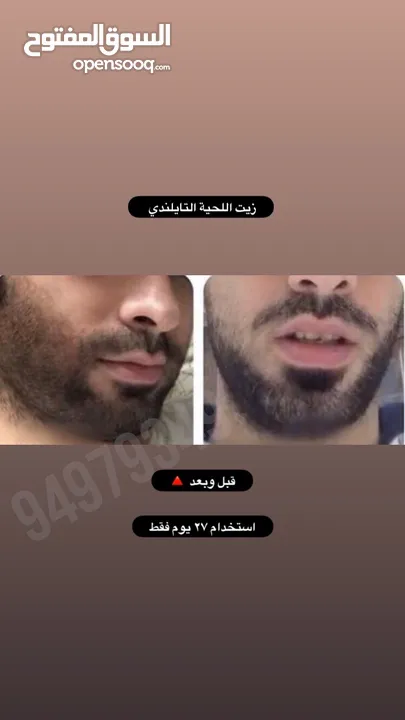 ينبت ويكثف اللحية والشنب/ مجرب ومضمون