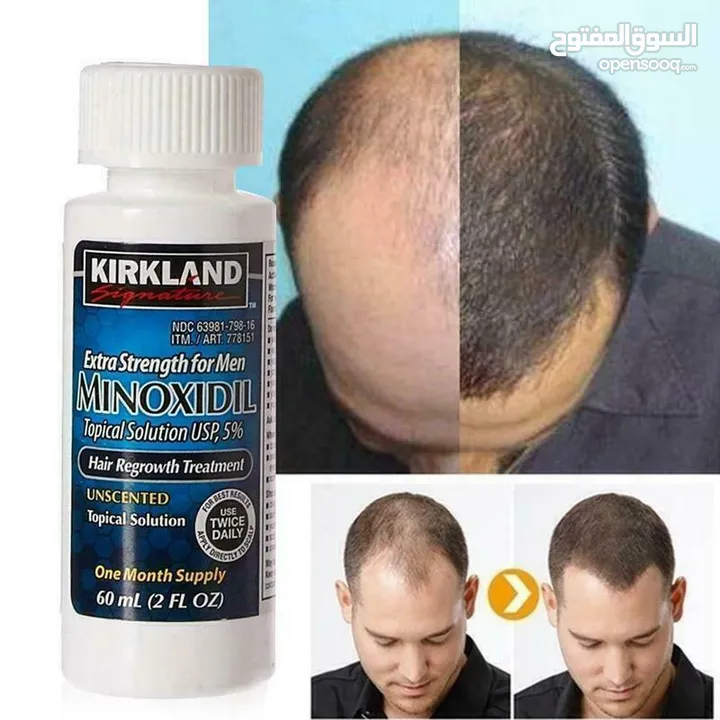 minoxidil منتج منع الصلع ونمو الشعر واللحيه