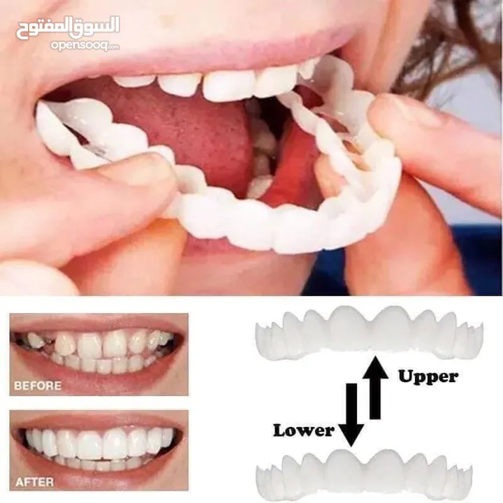 طقم اسنان  snapon smile