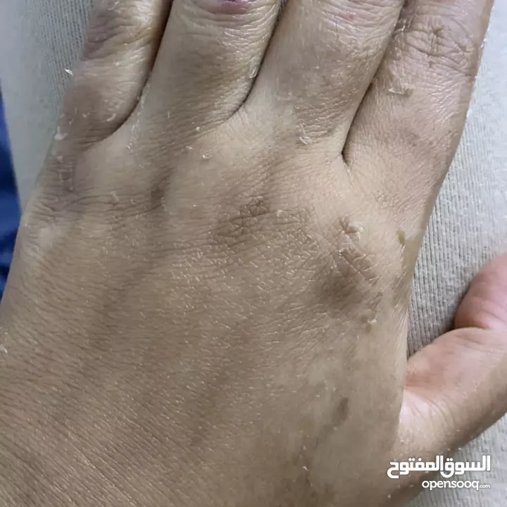 مقشر Magic hand لتقشير الجلد لجميع انواع البشرة