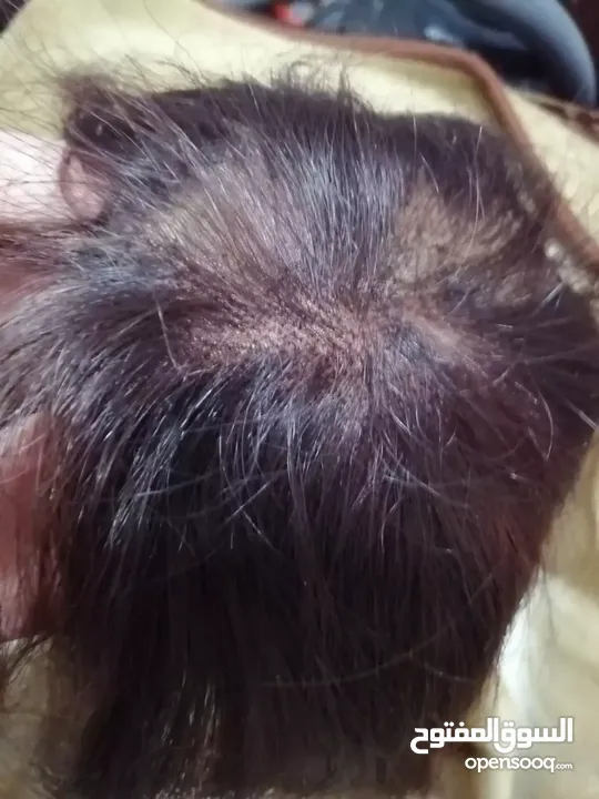 مقدمة شعر  طبيعي ميه بالميه