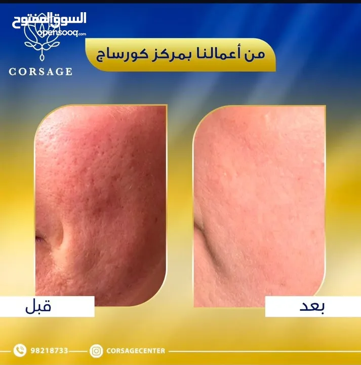 خدمات مركز تجميل